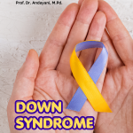 DOWN SYNDROME: Strategi Multisensori dalam Pembelajaran Berbicara (Monograf)